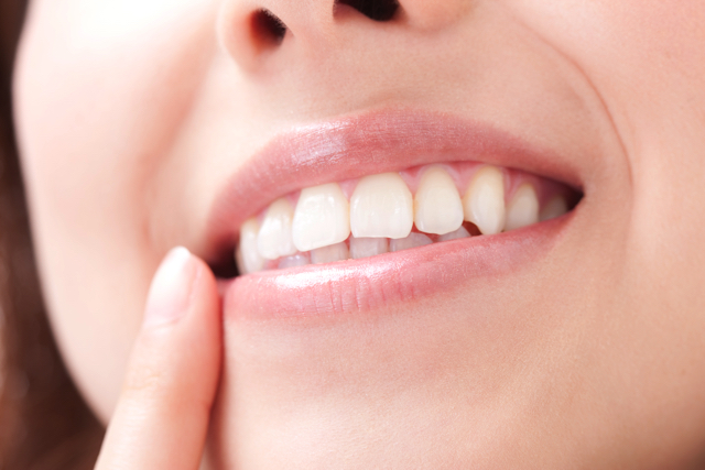 口元はその人の印象を大きく左右し、白く輝く歯は清潔で明るいイメージを与えます